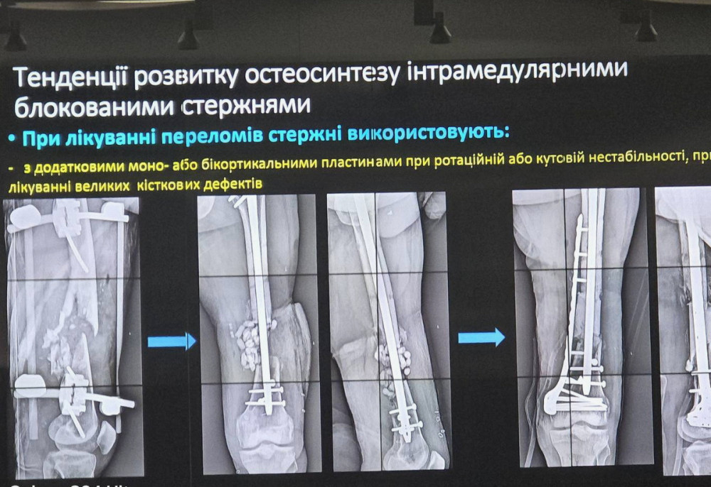 1790 image for slide