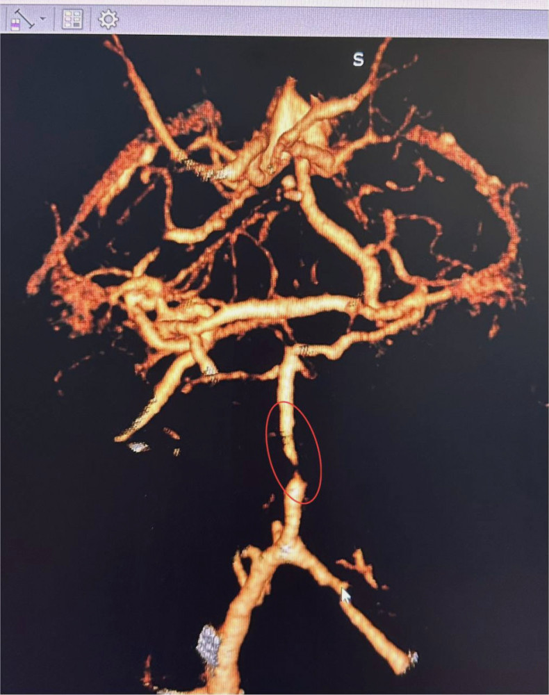 5072 image for slide