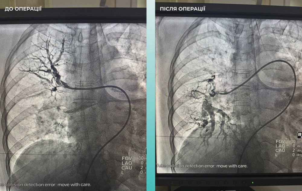 8476 image for slide