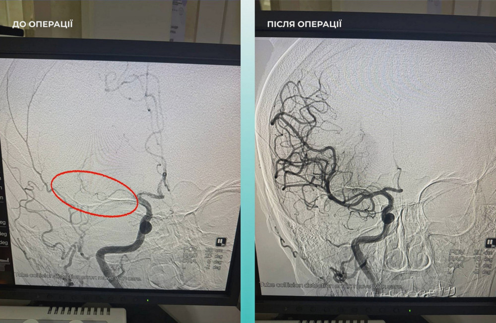 8477 image for slide