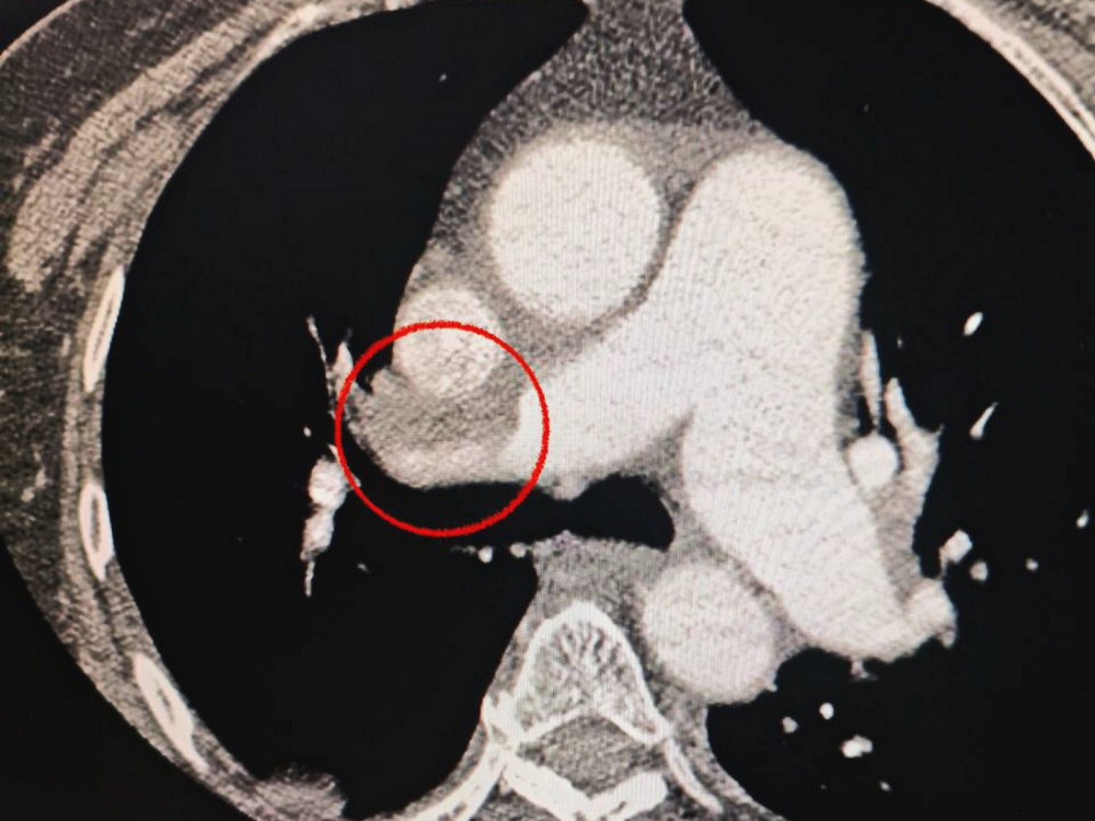 8479 image for slide